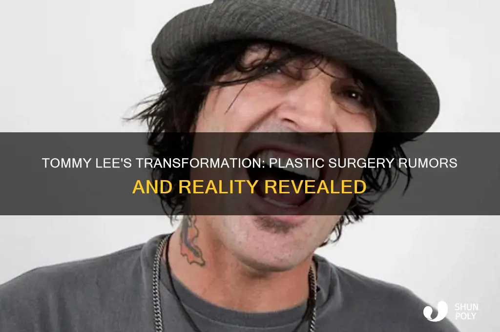 has tommy lee had plastic surgery