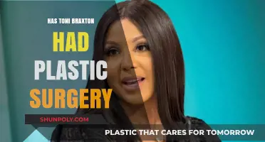 Toni Braxton's Transformation: Plastic Surgery Rumors and Speculations