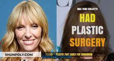 Toni Collette's Transformation: Plastic Surgery Rumors Explored and Debunked