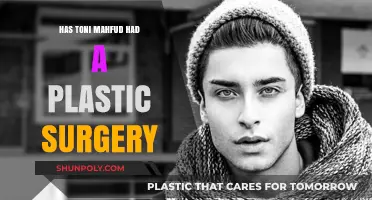 Has Toni Mahfud Had Plastic Surgery? Unveiling the Truth