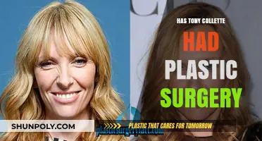 Tony Collette's Transformation: Plastic Surgery Rumors Explored and Debunked