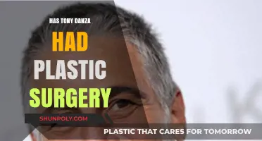 Tony Danza's Transformation: Plastic Surgery Rumors Explored