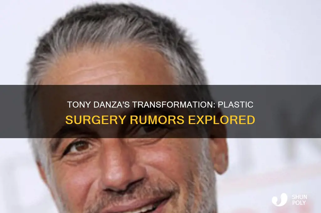 has tony danza had plastic surgery