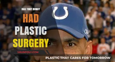 Tony Dungy Plastic Surgery Speculations: Fact or Fiction?