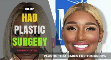 Has Top Undergone Plastic Surgery? Unveiling the Truth Behind the Rumors