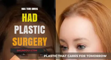 Tori Amos Plastic Surgery: Fact-Checking the Rumors and Speculations