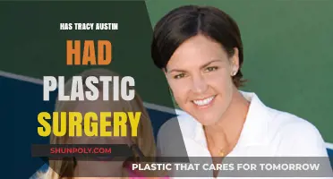 Tracy Austin's Transformation: Plastic Surgery Speculations and Truths Revealed