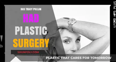 Tracy Pollan's Ageless Beauty: Plastic Surgery Speculations Explored