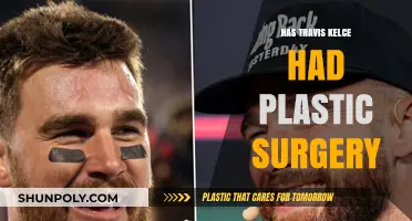 Travis Kelce's Transformation: Plastic Surgery Speculations and Facts Revealed