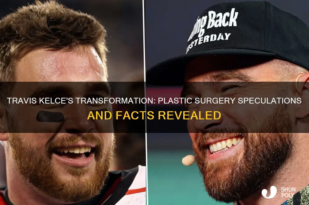 has travis kelce had plastic surgery