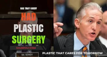 Tray Goedy Plastic Surgery: Fact-Checking the Rumors and Speculations