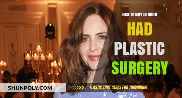 Trinny London's Transformation: Plastic Surgery Speculations and Truths