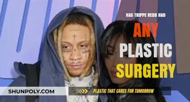 Trippie Redd's Transformation: Plastic Surgery Rumors Explored and Debunked