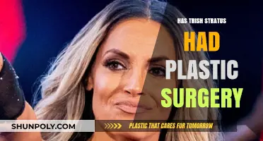 Trish Stratus Plastic Surgery: Fact-Checking the Rumors and Speculations