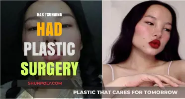 Has Tsunaina Had Plastic Surgery? Uncovering the Truth Behind the Rumors