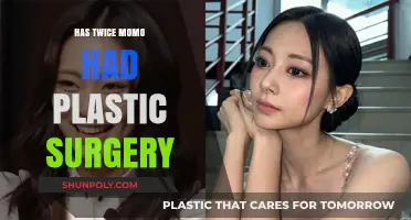 Twice Momo Plastic Surgery: Fact-Checking the Rumors and Speculations