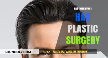 Tyler Hynes Plastic Surgery: Fact-Checking the Rumors and Speculations