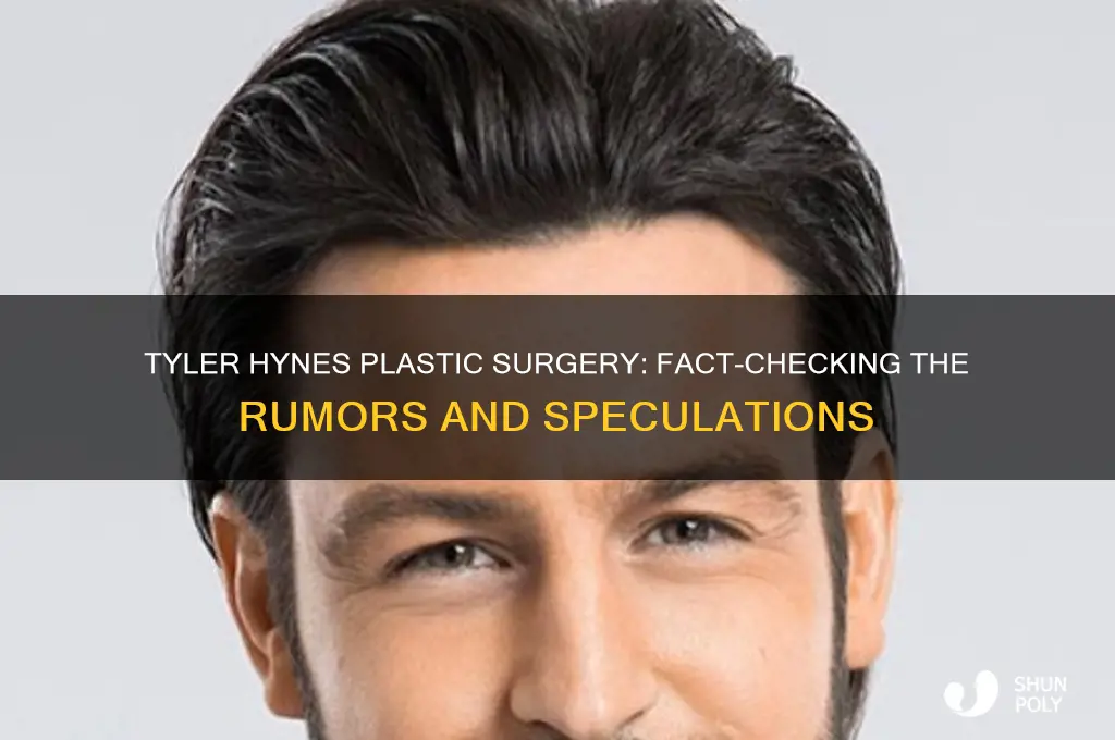 has tyler hynes had plastic surgery