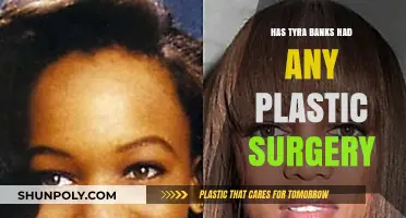 Tyra Banks Plastic Surgery: Fact-Checking Rumors and Speculations