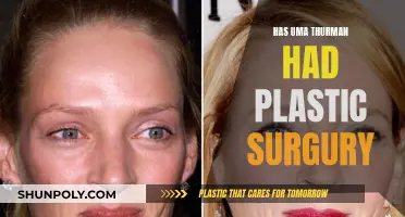 Uma Thurman's Plastic Surgery: Fact or Fiction?