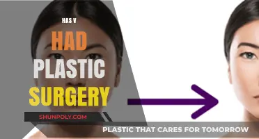 Has V Had Plastic Surgery? Uncovering the Truth Behind the Rumors