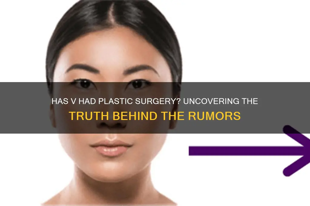 has v had plastic surgery