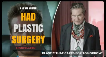 Val Kilmer's Transformation: Plastic Surgery Rumors and Reality Revealed