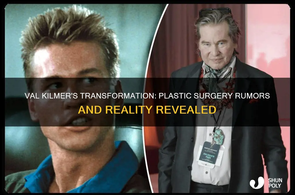 has val kilmer had plastic surgery