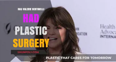 Valerie Bertinelli's Transformation: Plastic Surgery Speculations and Truths