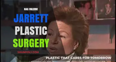 Valerie Jarrett Plastic Surgery: Fact-Checking the Rumors and Speculations
