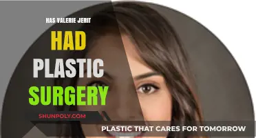 Valerie Jerit's Transformation: Plastic Surgery Speculations and Facts