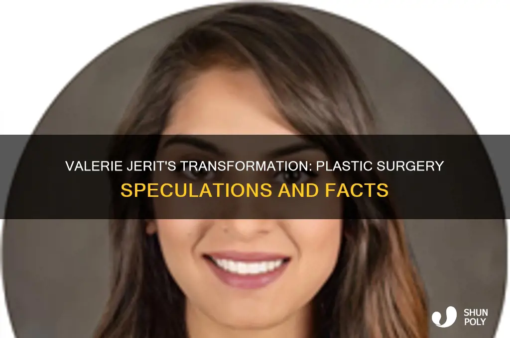 has valerie jerit had plastic surgery