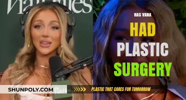 Has Vana Undergone Plastic Surgery? Analyzing the Speculations and Evidence