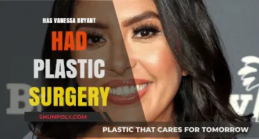 Vanessa Bryant's Transformation: Plastic Surgery Rumors and Speculations