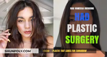 Vanessa Hudgens Plastic Surgery: Fact-Checking Transformation Rumors