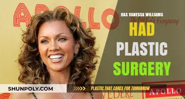 Vanessa Williams Plastic Surgery: Fact-Checking Rumors and Speculations