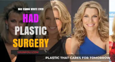 Vanna White's Beauty Secrets: Plastic Surgery Rumors Explored