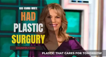 Vanna White's Plastic Surgery: What's the Truth?