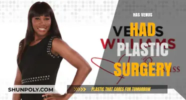Venus Williams Plastic Surgery: Fact or Fiction? Unveiling the Truth