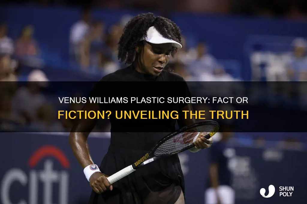 has venus had plastic surgery
