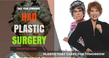 Vicki Lawrence's Transformation: Plastic Surgery Rumors and Reality Revealed