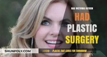 Victoria Osteen's Transformation: Plastic Surgery Rumors and Speculations