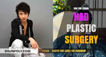 Vin Zhang Plastic Surgery: Fact or Fiction? Unveiling the Truth