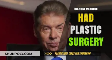 Vince McMahon's Transformation: Plastic Surgery Rumors Explored