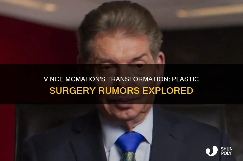 has vince mcmahon had plastic surgery
