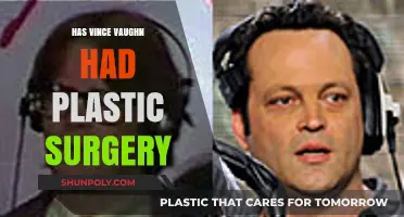 Vince Vaughn's Changing Looks: Plastic Surgery Rumors Explored