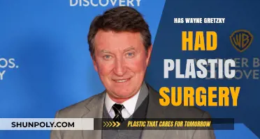 Has Wayne Gretzky Undergone Plastic Surgery? Unveiling the Truth