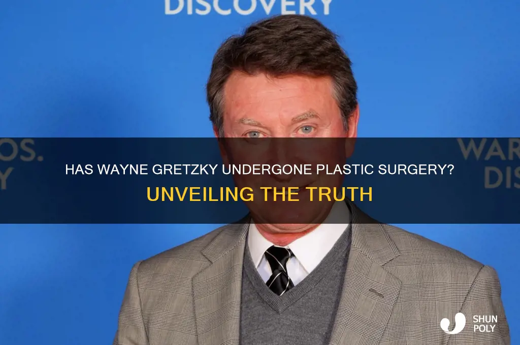 has wayne gretzky had plastic surgery