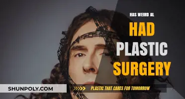 Weird Al Yankovic's Appearance: Plastic Surgery Rumors Explored