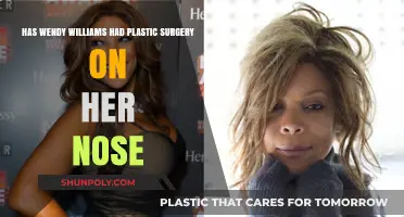 Wendy Williams' Nose Transformation: Plastic Surgery Speculations Explored